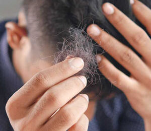 Behandla tunt hår och håravfall med plasma